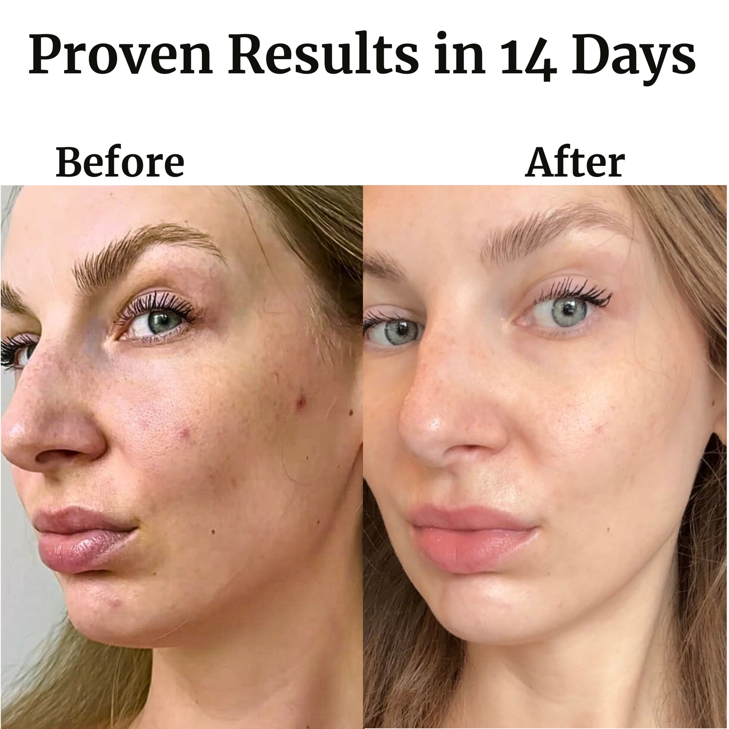 Infrared LED Light Therapy Mask