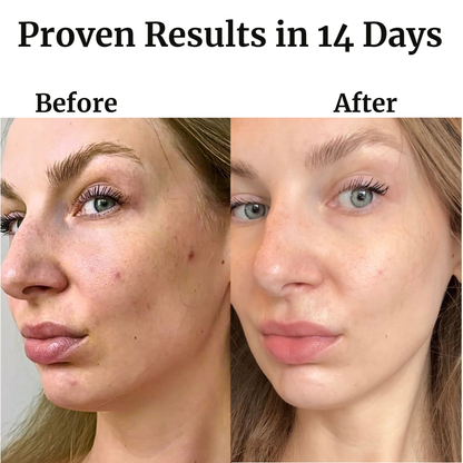 Infrared LED Light Therapy Mask