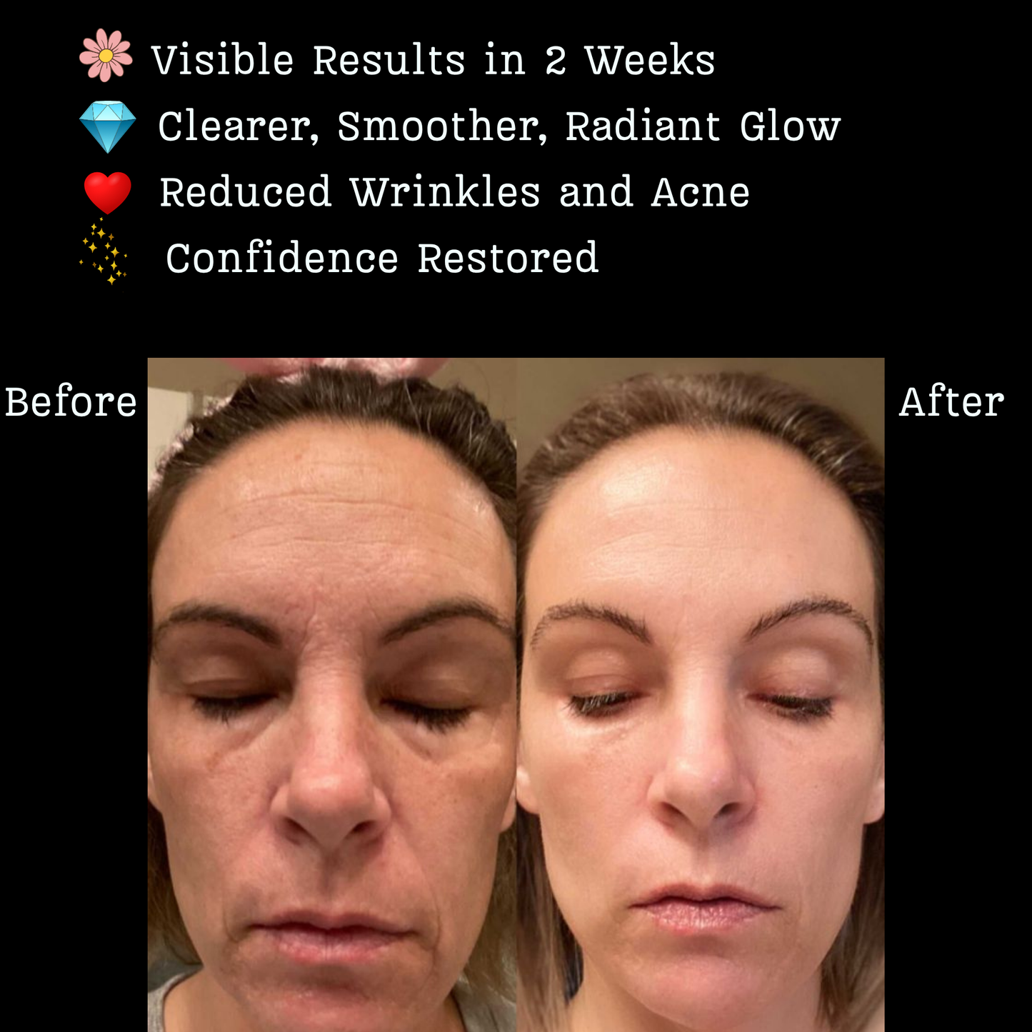 Infrared LED Light Therapy Mask