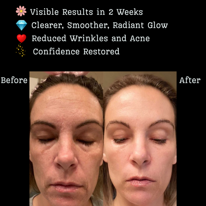 Infrared LED Light Therapy Mask